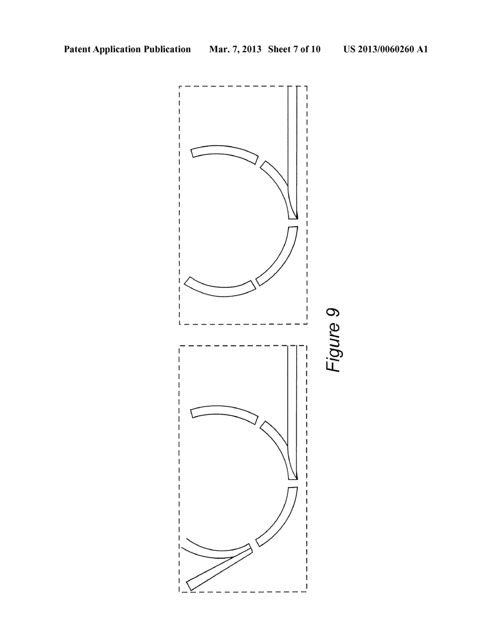 Multi-actuator array for the specific deformation of an implant - diagram, schematic, and image 08