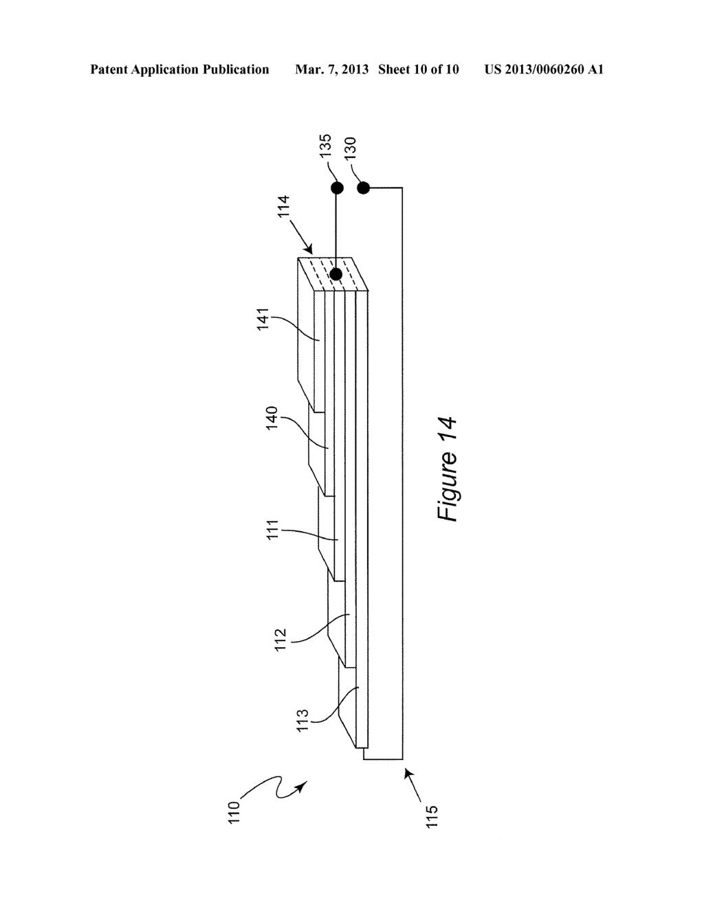 Multi-actuator array for the specific deformation of an implant - diagram, schematic, and image 11