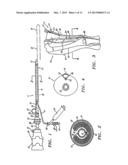 EXTRALUMINAL BALLOON DISSECTION diagram and image