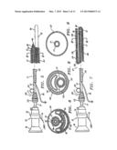 EXTRALUMINAL BALLOON DISSECTION diagram and image