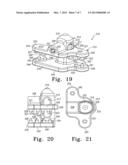 FLEXIBLE AND STATIC INTERSPINOUS/INTER-LAMINAR SPINAL SPACERS diagram and image