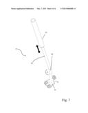 METHODS AND INSTRUMENTATION FOR ORTHOPEDIC SURGERY diagram and image