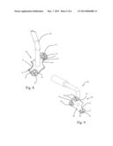 METHODS AND INSTRUMENTATION FOR ORTHOPEDIC SURGERY diagram and image