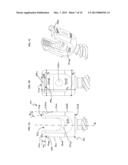 Bone Implants diagram and image