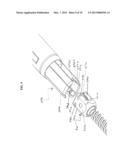 Bone Implants diagram and image