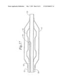 STENT DELIVERY SYSTEM HAVING STENT SECUREMENT APPARATUS diagram and image