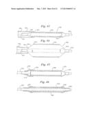 STENT DELIVERY SYSTEM HAVING STENT SECUREMENT APPARATUS diagram and image