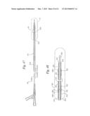 STENT DELIVERY SYSTEM HAVING STENT SECUREMENT APPARATUS diagram and image