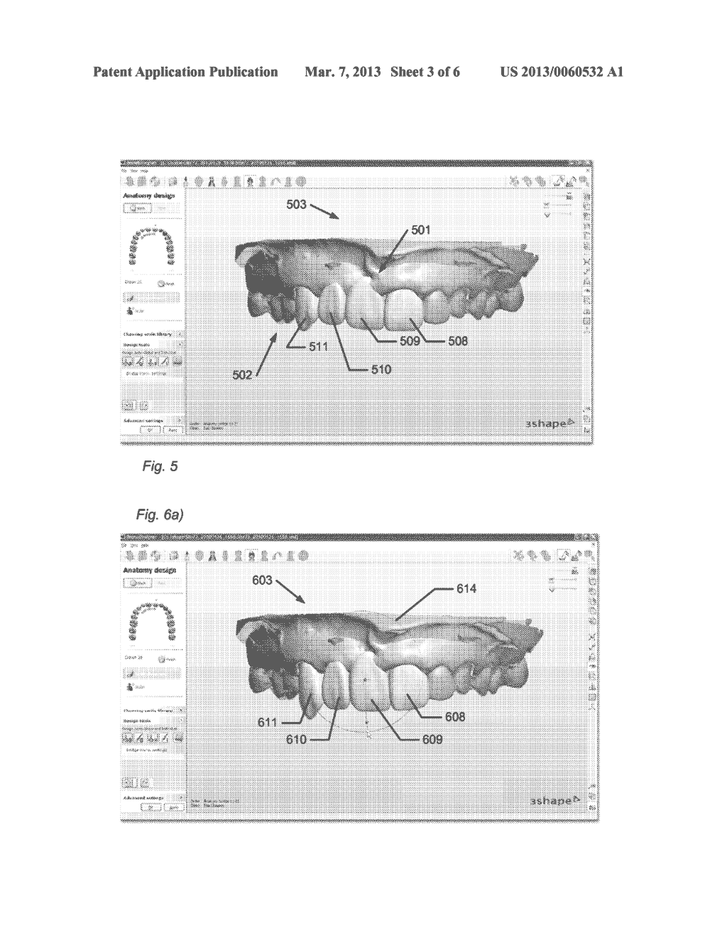 METHOD OF COMPOSING AND DESIGNING A SET OF TEETH - diagram, schematic, and image 04