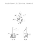 Self-Aligning Zipper diagram and image