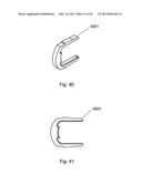 Self-Aligning Zipper diagram and image