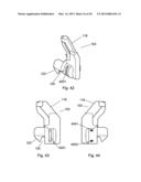 Self-Aligning Zipper diagram and image