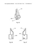 Self-Aligning Zipper diagram and image