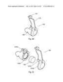 Self-Aligning Zipper diagram and image