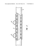 MEDICAL LEAD AND METHOD FOR MEDICAL LEAD MANUFACTURE diagram and image