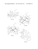 REVERSE DETACH MOUNTING SYSTEM diagram and image