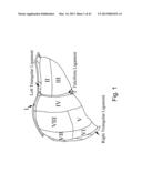 APPARATUS AND METHODS OF COMPENSATING FOR ORGAN DEFORMATION, REGISTRATION     OF INTERNAL STRUCTURES TO IMAGES, AND APPLICATIONS OF SAME diagram and image