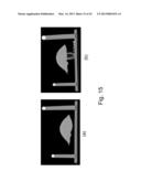 APPARATUS AND METHODS OF COMPENSATING FOR ORGAN DEFORMATION, REGISTRATION     OF INTERNAL STRUCTURES TO IMAGES, AND APPLICATIONS OF SAME diagram and image