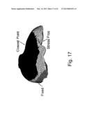 APPARATUS AND METHODS OF COMPENSATING FOR ORGAN DEFORMATION, REGISTRATION     OF INTERNAL STRUCTURES TO IMAGES, AND APPLICATIONS OF SAME diagram and image