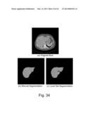 APPARATUS AND METHODS OF COMPENSATING FOR ORGAN DEFORMATION, REGISTRATION     OF INTERNAL STRUCTURES TO IMAGES, AND APPLICATIONS OF SAME diagram and image