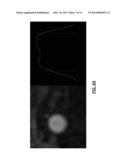 DETERMINING CONTOURS OF A VESSEL USING AN ACTIVE CONTOURING MODEL diagram and image