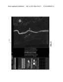 DETERMINING CONTOURS OF A VESSEL USING AN ACTIVE CONTOURING MODEL diagram and image