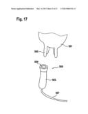 APPLIANCE FOR AT LEAST PARTIALLY STERILIZING A CONTAMINATED SURFACE diagram and image