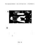 ANTI-ICAM-1 SINGLE DOMAIN ANTIBODY AND USES THEREOF diagram and image