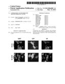 COMPOSITIONS AND METHODS FOR TREATING PROSTATE CANCER diagram and image