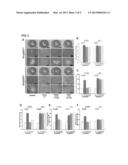 METHOD OF DETERMINING DOSE AND ADMINISTRATION OF STATIN diagram and image