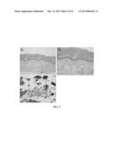 METHOD FOR DIAGNOSING MELANOCYTIC PROLIFERATIONS diagram and image