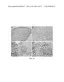 METHOD FOR DIAGNOSING MELANOCYTIC PROLIFERATIONS diagram and image