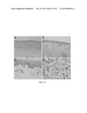 METHOD FOR DIAGNOSING MELANOCYTIC PROLIFERATIONS diagram and image