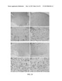 METHOD FOR DIAGNOSING MELANOCYTIC PROLIFERATIONS diagram and image