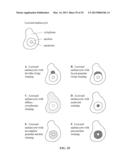 METHOD FOR DIAGNOSING MELANOCYTIC PROLIFERATIONS diagram and image