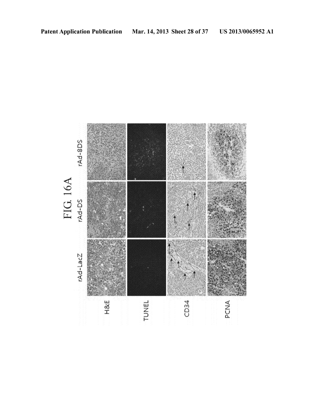 TUMOR-SPECIFIC PROMOTER AND ONCOLYTIC VIRUS VECTOR COMPRISING THE SAME - diagram, schematic, and image 29