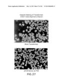 Use of Antisense Oligonucleotides or siRNA to Suppress Expression of     eIF-5A1 diagram and image