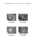 Use of Antisense Oligonucleotides or siRNA to Suppress Expression of     eIF-5A1 diagram and image