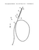 HEART ASSIST DEVICE WITH EXPANDABLE IMPELLER PUMP diagram and image