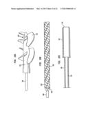 HEART ASSIST DEVICE WITH EXPANDABLE IMPELLER PUMP diagram and image