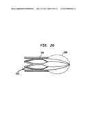 HEART ASSIST DEVICE WITH EXPANDABLE IMPELLER PUMP diagram and image