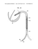 HEART ASSIST DEVICE WITH EXPANDABLE IMPELLER PUMP diagram and image