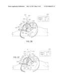 Axial Surgical Trajectory Guide diagram and image