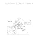 Axial Surgical Trajectory Guide diagram and image