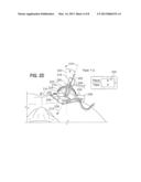 Axial Surgical Trajectory Guide diagram and image