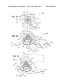 Axial Surgical Trajectory Guide diagram and image