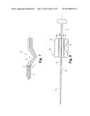 VASCULAR SUTURING DEVICE diagram and image