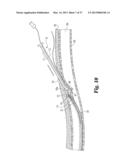 VASCULAR SUTURING DEVICE diagram and image