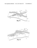 VASCULAR SUTURING DEVICE diagram and image