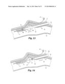 VASCULAR SUTURING DEVICE diagram and image